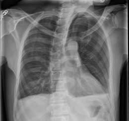 Radiology